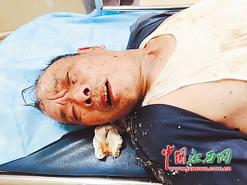 新建县礼步湖公园一老人突然倒地抽搐无身份证