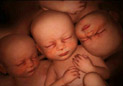 子宫内的多胞胎世界