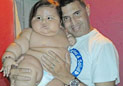 8个月男婴重达40斤