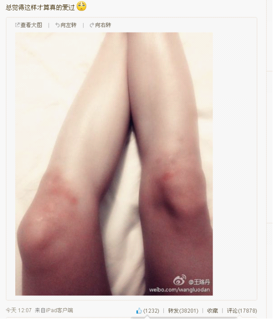 王珞丹微博晒双膝淤青照 “真的爱过”成网络流行语