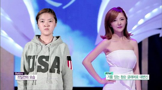 韩国女子被丈夫嫌丑遭打骂 整容后丈夫态度大