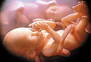 胎儿性别形成过程图，X和Y精子数量基本相同