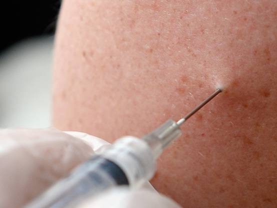 科学家正开发一种用于预防艾滋病的疫苗