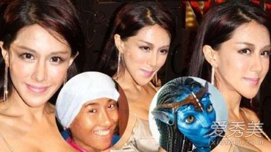 32位明星整容对比照 面部僵硬嘴歪不算啥?