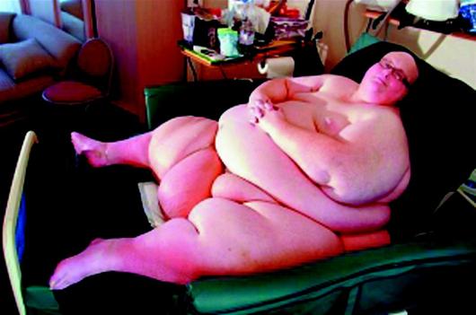 图为：梅森曾被冠以“世界最胖”头衔