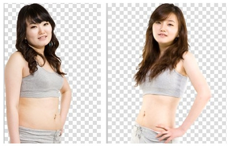 溶脂<em>减肥</em>案例:30岁<em>女子</em>腰<em>腹部</em>赘肉消失