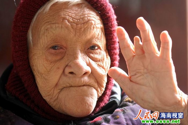 最后的红色娘子军卢业香:ICU病房治疗 已心衰