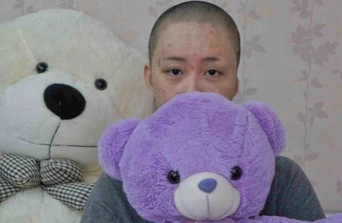 被官二代毁容少女索赔360余万 拒求爱被浇汽油