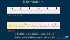 中国医院现场直击：房颤经导管射频消融术