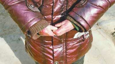 活在卫生纸里的男孩:想给他个拥抱都好难