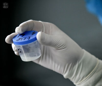 实拍:志愿者精子捐献全过程(组图)