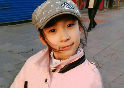 9岁女孩为救姥姥冲入火海重度烧伤