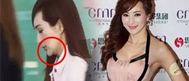 50岁女星下巴变尖疑整容 港媒曝其被两富豪包养