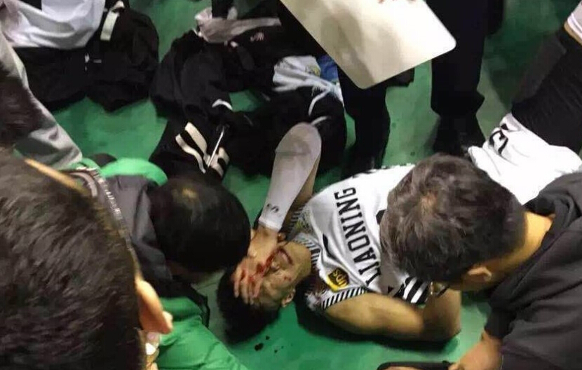 北京时间12月18日，辽篮主场大胜新疆男篮，赛后，郭艾伦被观众席飞来罐头瓶砸破脸 疼痛难忍。