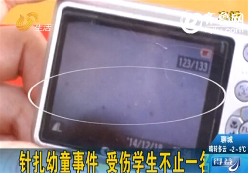 济南针扎幼童事件追踪:教师无证上岗受伤学生