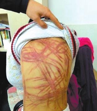 南京虐童案孩子生母上诉:判决结果太不近人情