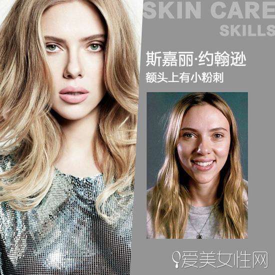 斯嘉丽-约翰逊 “黑寡妇”斯嘉丽-约翰逊被认为是当代好莱坞的性感象征,也进入过许多“世界性感女性”的列表,成为唯一一位两度被列为“当今最性感女性”的女星。但其实跟她的美肌也是一样的出名!全球知名的美国艺术家、画家、摄影师ChuCK Close曾用20*24宝丽来撕拉片拍摄斯嘉丽的素颜照,在这么清晰的镜头下,无修片一次成像,素颜的斯嘉丽照样是美美哒!