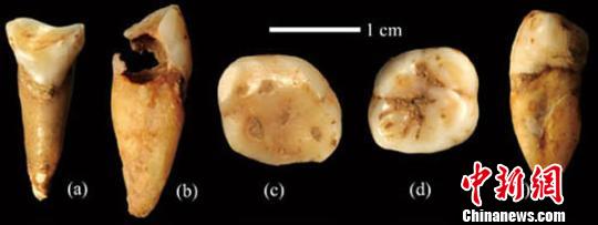 湖南道县古人类遗址再次发掘20枚人类牙齿化石