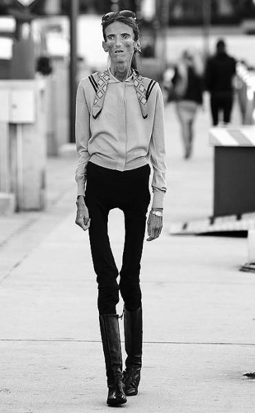 厌食症患者的骨感现实_读书频道_凤凰网