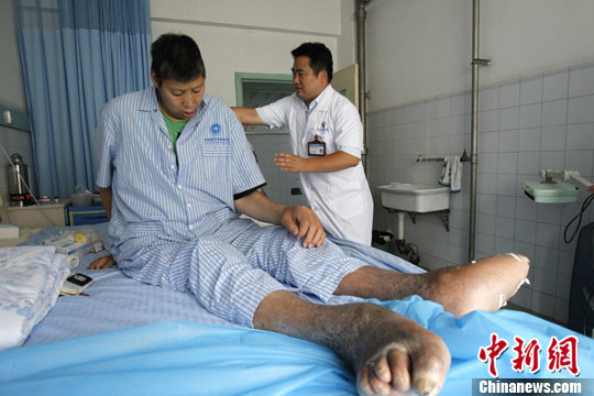 亚洲巨人王峰军接受免费救治有望重新屹立