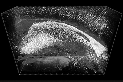 年度图片 透明大脑|通古斯|科学家