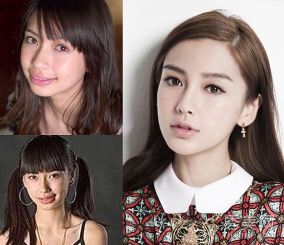 明星整容前后对比 男隆鼻女削骨