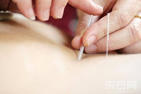 针灸专用银针非一次性 fed0ee3f-eb6e-4777-a304-c001b0962d07.jpg