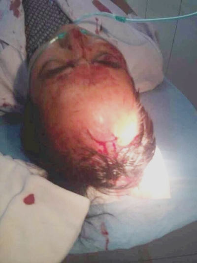 甘肃省中医院发生暴力伤医事件 被打医生目前还在重症