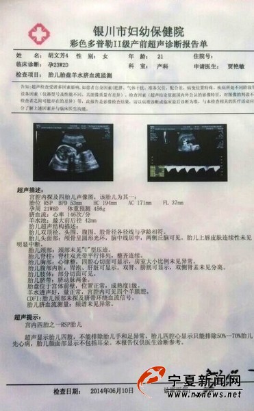医院关于四胞胎的相关彩超。