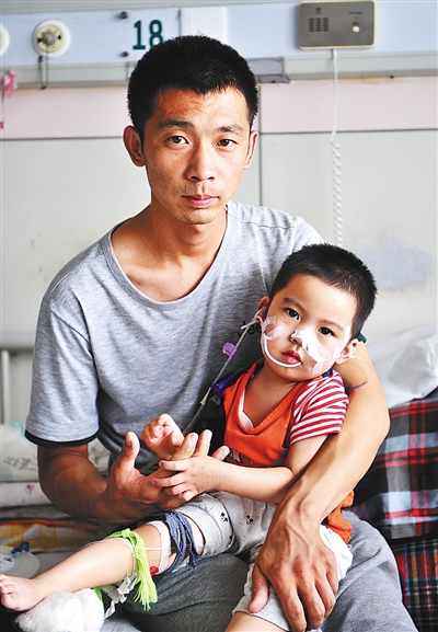 喂食爸爸<em>女儿小可</em>然完成手术|爸爸|营养不良