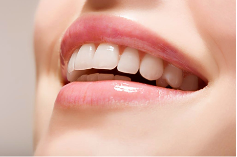 超薄瓷贴面缔造玲珑皓齿|烤瓷牙|口腔_凤凰财经