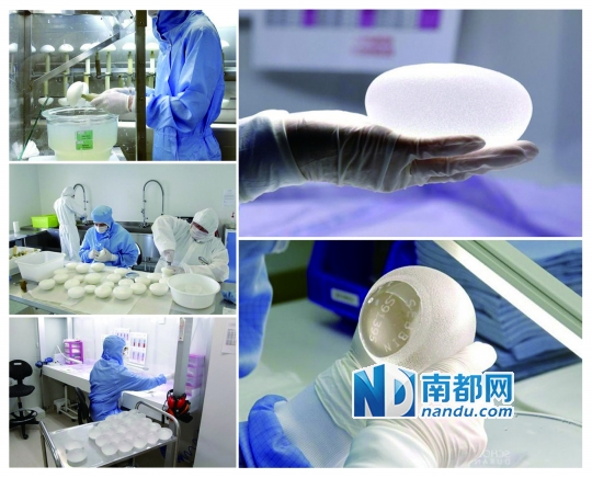 中山医顶级假体高端定制。