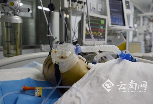 多处受伤的小婷躺在医院里记者刘筱庆摄