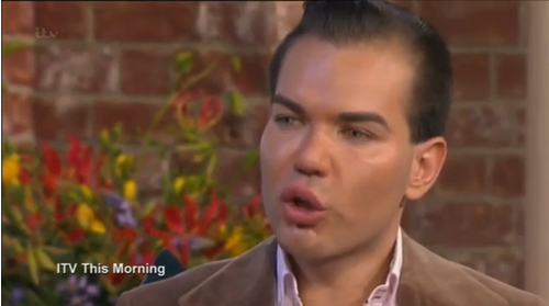 阿尔维斯为了变成像芭比娃娃男友一样“理想的男人”,花费超过10万欧元整形。(网页截图)