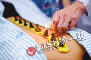 耳后止痛贴是什么原理_钱是万能止痛贴图片