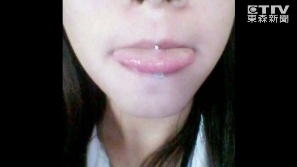 ▲初中少女“穿舌环感染肠胃炎”,家长怒求偿。图片来源:台湾东森新闻