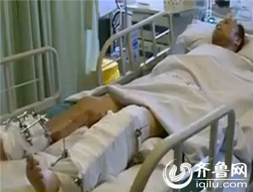 青州男子焊接时两条腿被炸伤 急需熊猫血救援