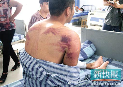 ■受伤的艺术团成员。