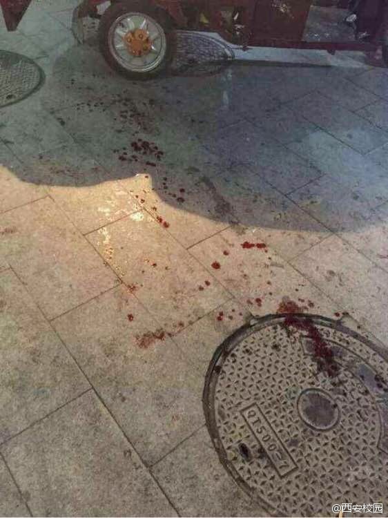 西安文理学院一学生揭穿小偷被捅3刀 血洒满地
