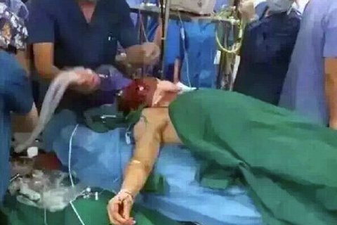 医生王建军面部颈部被砍。图片来源网络