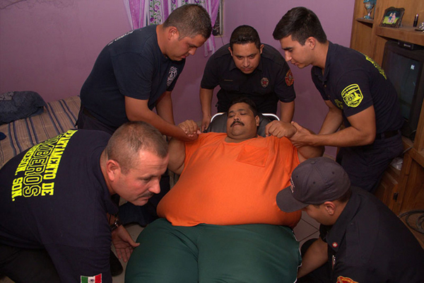 世界最胖男子减肥手术后患疝气，被迫切除80厘米肠道。(网页截图)