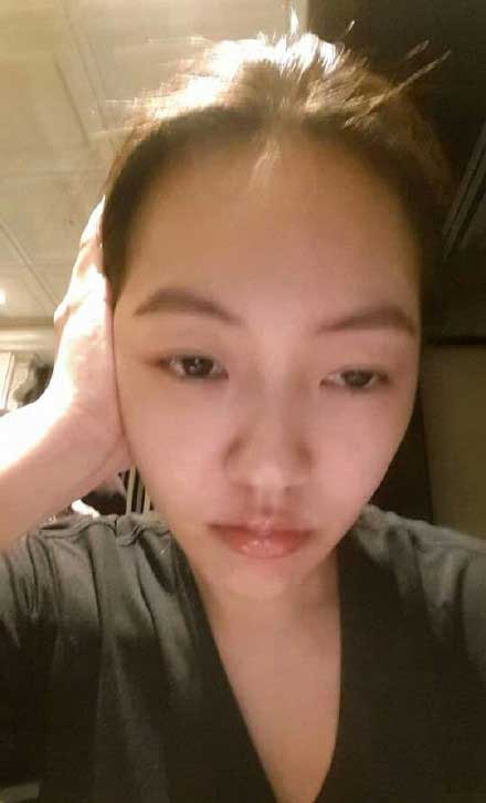 小S晒素颜自拍照表情痛苦 自曝患中耳炎(图)|微