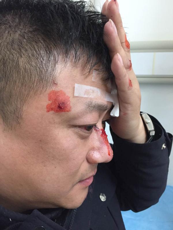 男子无证违法开车被拦,逃逸时带倒上海一交警