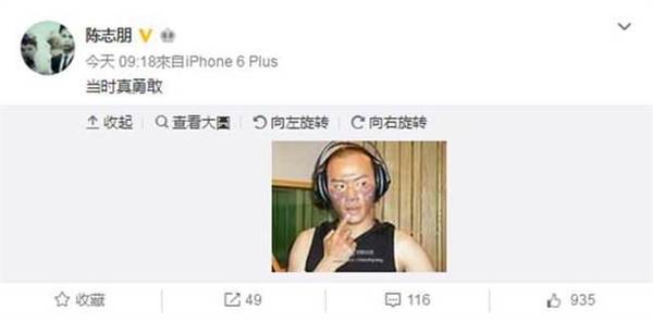 陈志朋公开昔日烧伤照。（图／翻摄自陈志朋微博）图片来源：台湾《中时电子报》