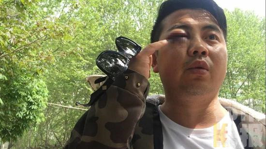 陕西镇政府官员将下属打伤:发20块钱红包他抢