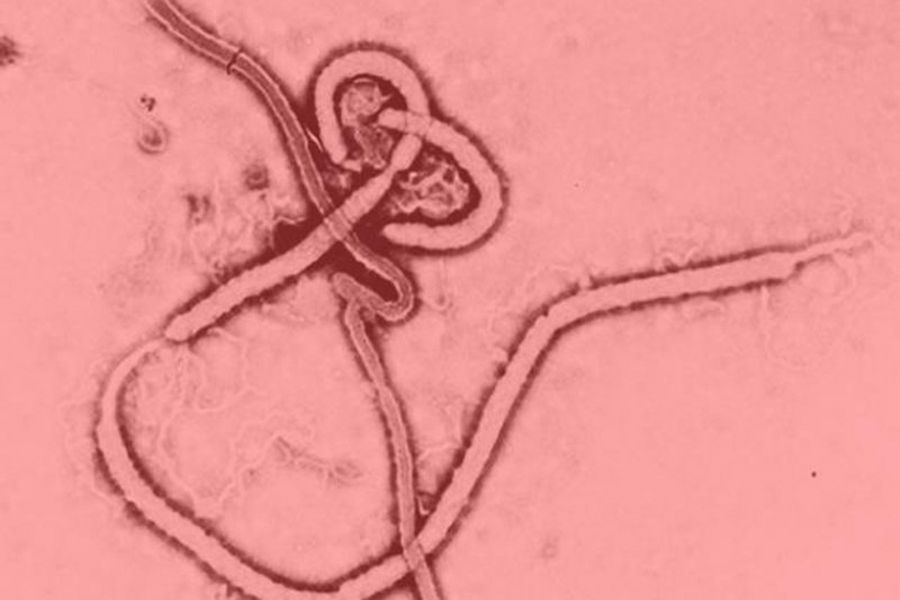 利用电子显微镜对埃博拉病毒属成员的研究显示，其呈现一般纤维病毒的线形结构。病毒粒子也可能出现“U”字、“6”字形、缠绕、环状或分枝形，病毒粒子一般直径约80纳米，但长度可达1400纳米，典型的埃博拉病毒粒子平均长度则接近1000纳米。