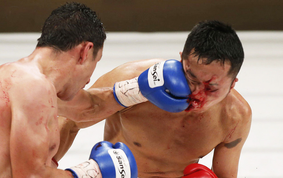 日本卫冕拳王遭暴打