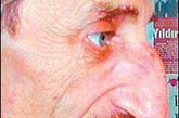 世界上最大的鼻子 　　土耳其57岁的建筑者梅赫梅特.奥兹约雷克由于长着一个长度达8.8厘米长的鼻子，被正式命名为“长有世界上最大鼻子之人”，而他的巨型鼻子也被列入吉尼斯世界纪录。
