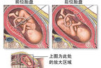 图解胎儿脐血取样全过程