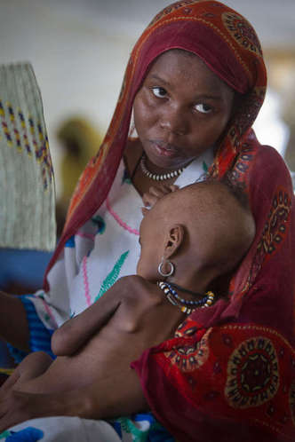 西非萨赫勒百万儿童面临营养危机(组图)